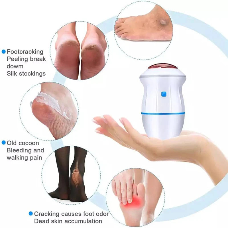 Electric Foot Callus Remover